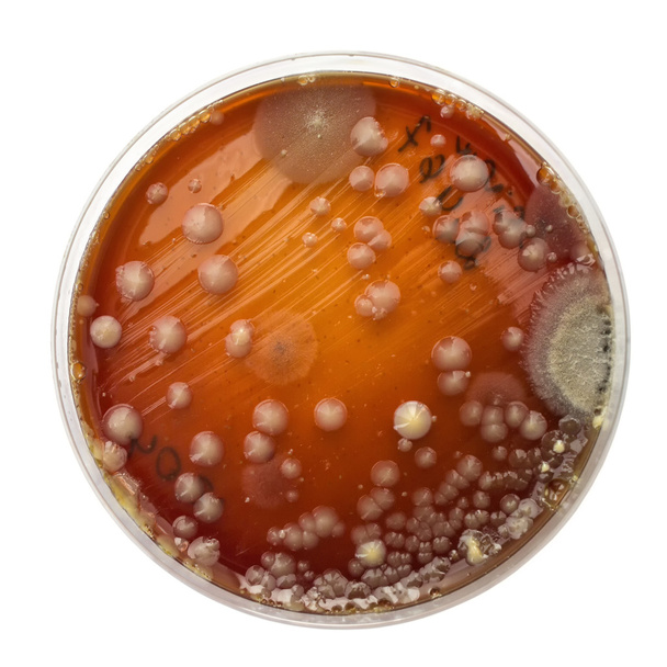 Petri dish with bacteria colonies - Photo, Image
