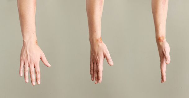 Крупним планом вид огидних ран на зап'ясті під різними кутами
 - Фото, зображення