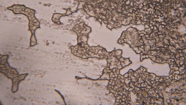 Ztuhlé krevních buněk pod mikroskopem - Záběry, video
