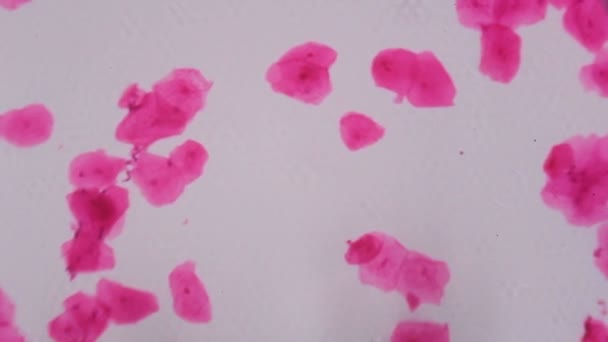 Épithélium pavimenteux multiple au microscope - Pois roses abstraits sur fond blanc
 - Séquence, vidéo