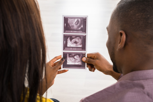 Couple With Ultrasound Scan Report - Foto, imagen