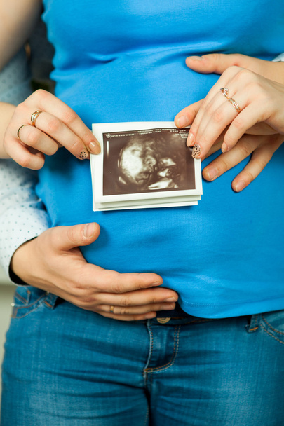 Tulevat vanhemmat pitävät ultraäänitutkimuksen tulosta
  - Valokuva, kuva
