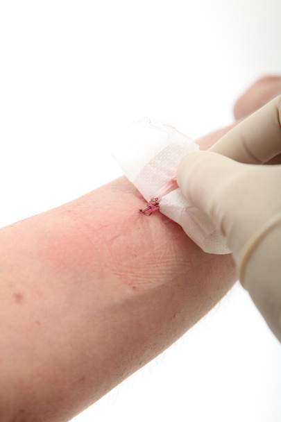Doctor checking bleeding from vein - Foto, imagen