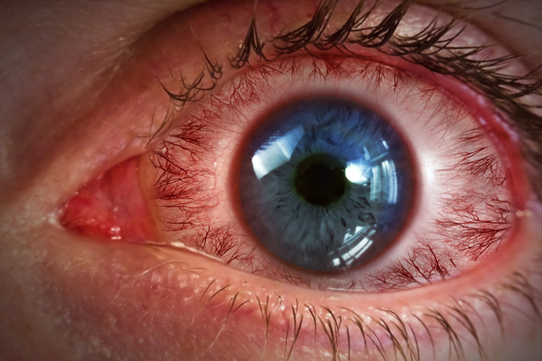 Macro globo ocular rojo
 - Foto, Imagen
