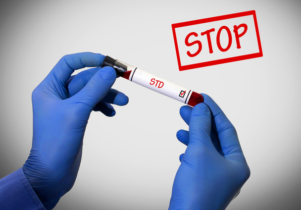 Stop Std (choroba weneryczna) - Zdjęcie, obraz