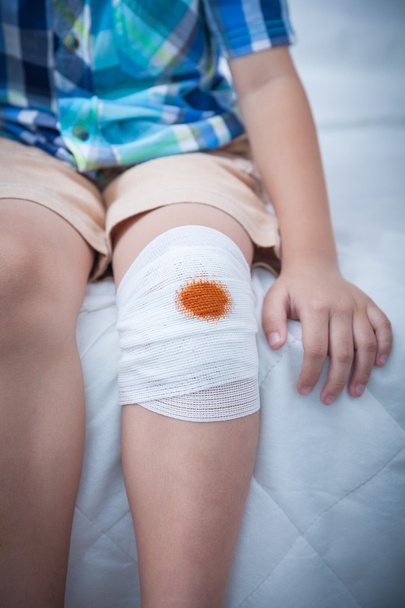 Kind verletzt. Wunde am Knie des Kindes mit Verband. - Foto, Bild