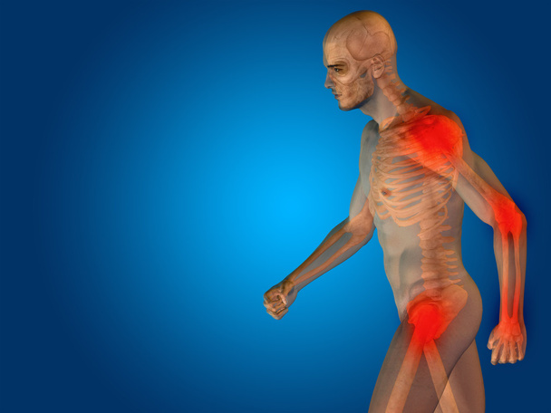 суставы или боли в суставах
 - Фото, изображение