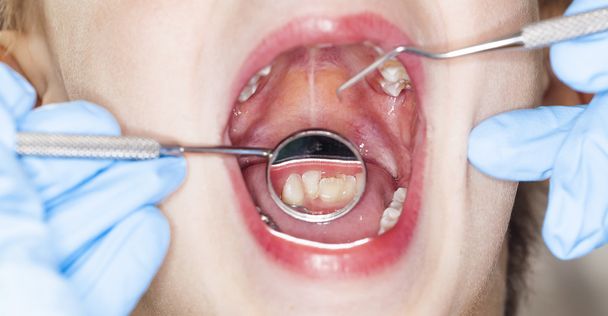 inspection de la cavité buccale de l'enfant dentiste dentaire
 - Photo, image