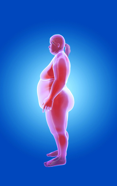 Lihava ja laiha nainen. röntgenkuva
 - Valokuva, kuva