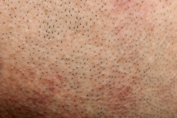 Close-up van de menselijke huid - Foto, afbeelding