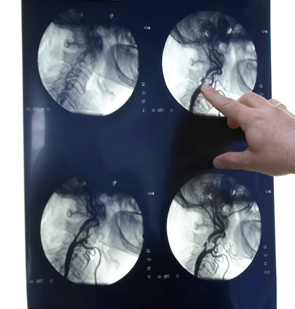 Radiología nueva 2
 - Foto, imagen
