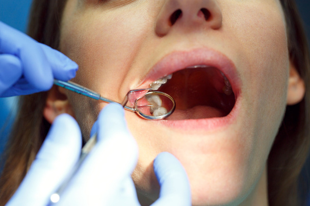 Γυναίκα να πάρει μια οδοντιατρική θεραπεία - Φωτογραφία, εικόνα