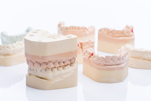 Tanden mallen op een helder witte tafel - Foto, afbeelding