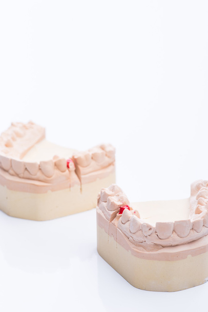 Teeth molds on a bright white table - Photo, Image