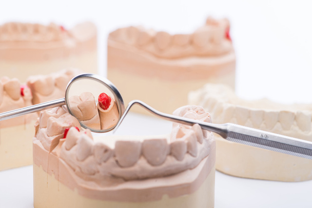 Δόντια καλούπια με βασικές οδοντιατρικών εργαλεία σε ένα φωτεινό λευκό τραπέζι - Φωτογραφία, εικόνα