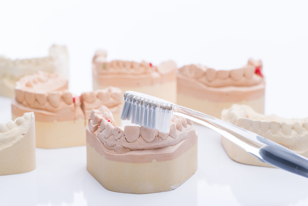 Καλούπια δόντια με οδοντόβουρτσα σε ένα φωτεινό λευκό τραπέζι - Φωτογραφία, εικόνα