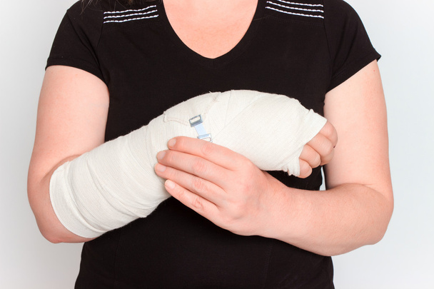 mladá žena se zlomenou rukou v obsazení - Fotografie, Obrázek