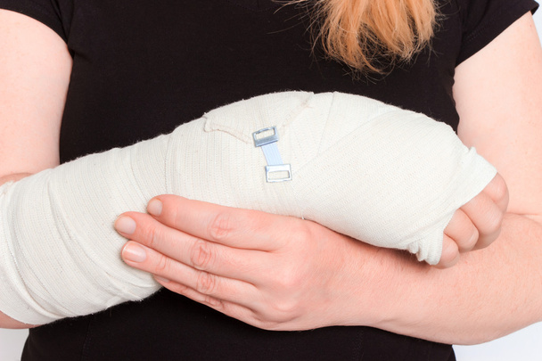 молодая женщина со сломанной рукой в гипсе
 - Фото, изображение