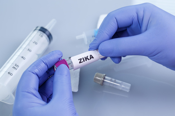 Krevní kolekce trubky s popisky Zika virus - Fotografie, Obrázek