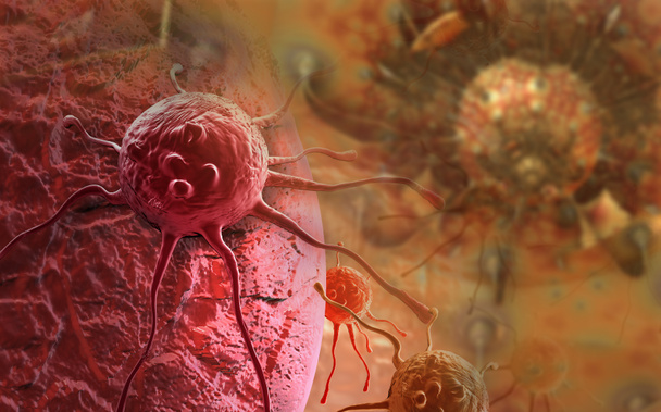 απόδοσης 3D καρκίνου κυττάρων στο ανθρώπινο σώμα   - Φωτογραφία, εικόνα