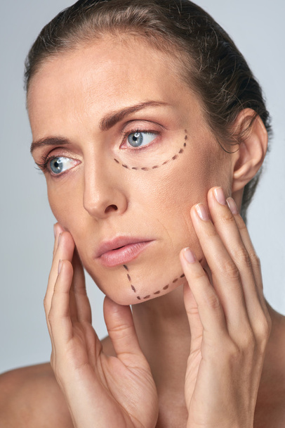 close up of surgery lines on woman's face - Φωτογραφία, εικόνα