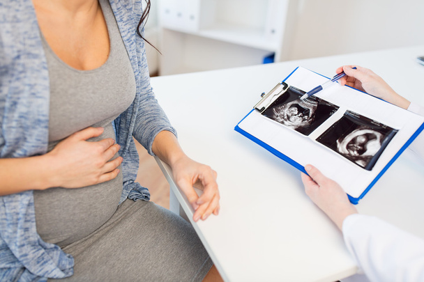 lähikuva lääkäri ja raskaana oleva nainen ultraääni
 - Valokuva, kuva