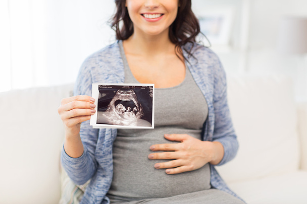 close up of pregnant woman with ultrasound image - Foto, Imagen