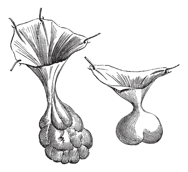 Fig. 594. Dos tipos diferentes de sacos herniales., grabado vintage
 - Vector, imagen