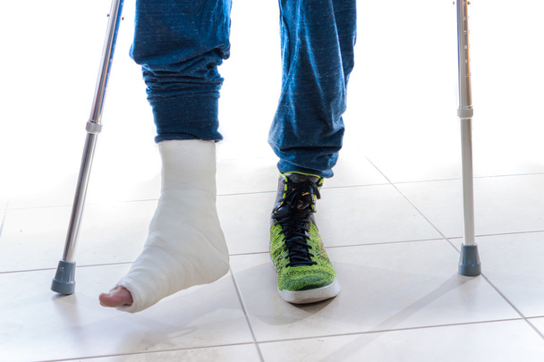 Junger Mann mit gebrochenem Knöchel und Gips - Foto, Bild
