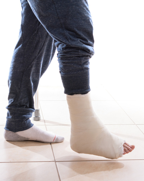 Молодой человек со сломанной лодыжкой и слепленной ногой
 - Фото, изображение