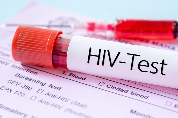 HIV test label on HIV infection screening test form. - Zdjęcie, obraz