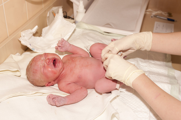 treatment of newborn - Photo, Image