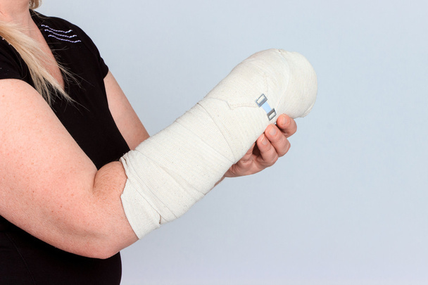 молода жінка з розбитою рукою в кастинг
 - Фото, зображення