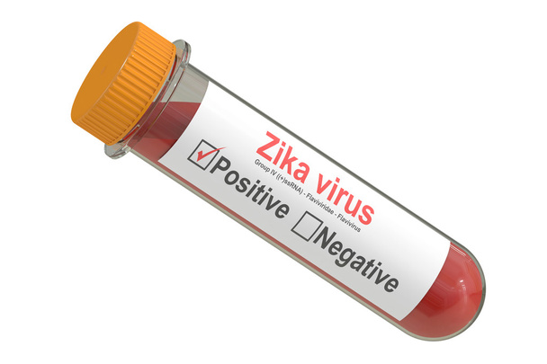 Test tube with blood sample positive with Zika virus, 3D renderi - Zdjęcie, obraz