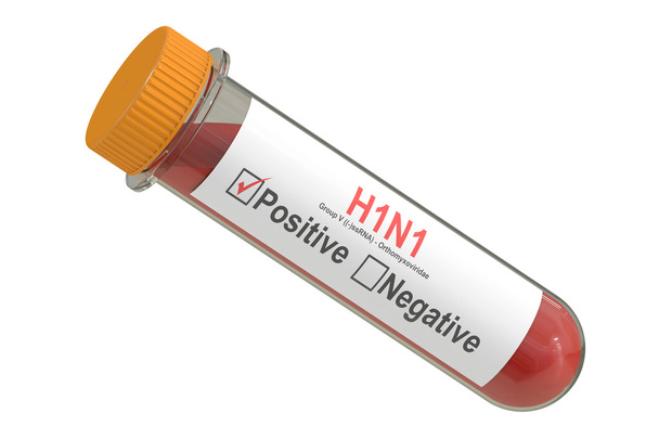 Test tube with blood sample positive with H1N1 virus, 3D renderi - Fotoğraf, Görsel