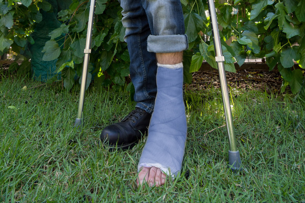 Young man with a leg cast in a garden - Photo, Image