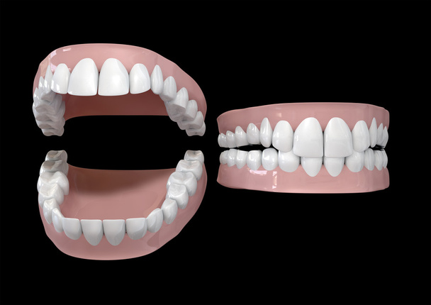 Zähne und Zahnfleisch offen und geschlossen - Foto, Bild