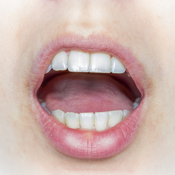 Dientes naturales en la boca de una mujer medio abierta
 - Foto, imagen
