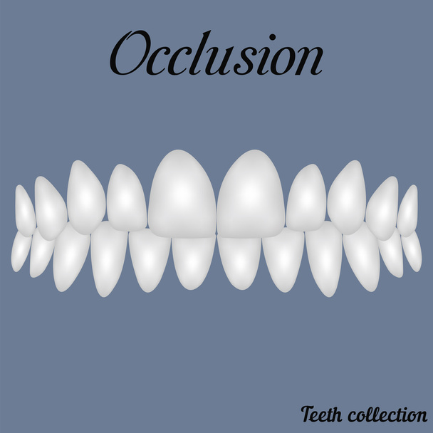 okkluusiota puristi hampaat
 - Vektori, kuva