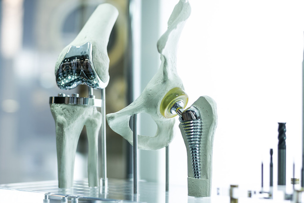 Prótesis de rodilla y cadera para medicina
 - Foto, imagen