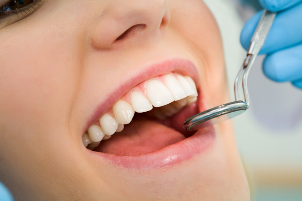 Dental checkup - Fotoğraf, Görsel