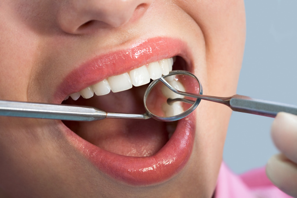 hastalar daha önce oral muayene ağzı açık - Fotoğraf, Görsel