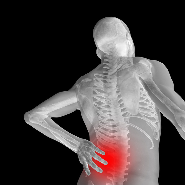  Анатомія людини з болем у спині
  - Фото, зображення