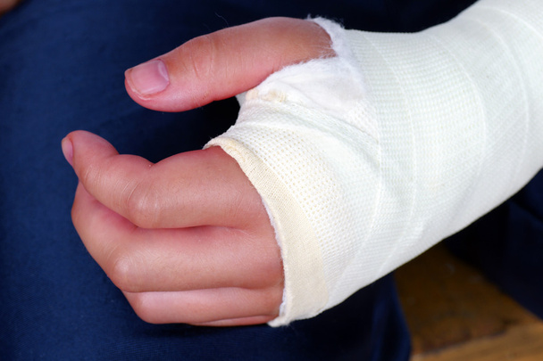 Broken hand with plaster cast close up - Foto, Imagem