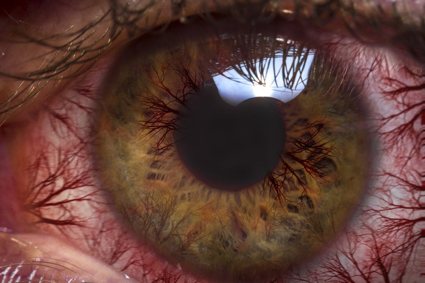 Macro bulbo oculare rosso
 - Foto, immagini