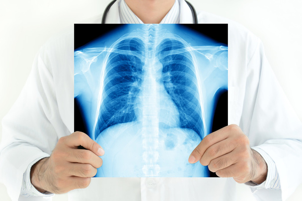 Docteur tenant une image radiographique de la poitrine masculine normale
 - Photo, image