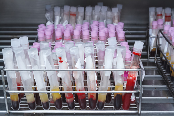 Residuos médicos, tubos de muestras de sangre después del análisis de laboratorio
   - Foto, Imagen