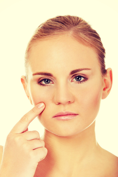 Unhappy young woman touching her pimple - Photo, image