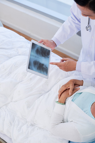 Médico explicando resultados de rayos X al paciente
 - Foto, Imagen