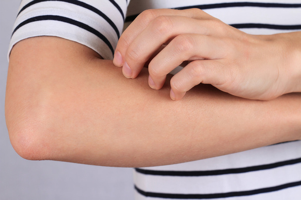 Scratching an itch. Skin,Allergic Reaction, Irritation - Foto, Bild